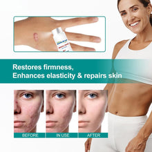 Load image into Gallery viewer, Advanced Scar Spray For All Types of Scars - For example Acne Scars, Surgical Scars and Stretch Marks