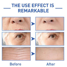 गैलरी व्यूवर में इमेज लोड करें, Face Boost Anti-Aging Serum (Botox )