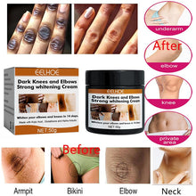 Load image into Gallery viewer, Experts Recommend Product - The Most Popular Whitening Cream in 2023