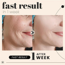 Load image into Gallery viewer, Collagen tight hydration and moisturizing mask