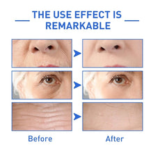 Load image into Gallery viewer, Botox Face Serum