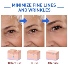 Load image into Gallery viewer, Botox Face Serum