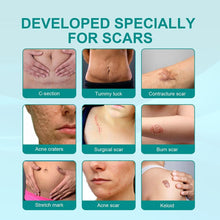 Load image into Gallery viewer, Advanced Scar Spray For All Types of Scars - For example Acne Scars, Surgical Scars and Stretch Marks