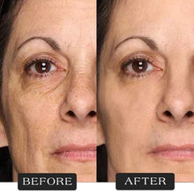 गैलरी व्यूवर में इमेज लोड करें, Protein Thread Lifting Set