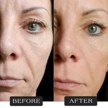 गैलरी व्यूवर में इमेज लोड करें, Protein Thread Lifting Set