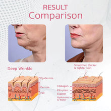 Load image into Gallery viewer, TENSPulse VFace Sleeping Beauty Device