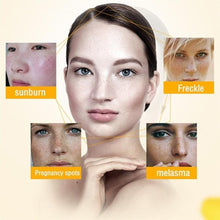 Load image into Gallery viewer, Freckle Whitening Cream