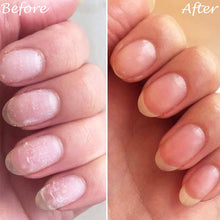 गैलरी व्यूवर में इमेज लोड करें, Nail Repair Protection Gel