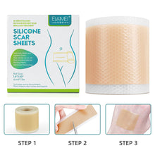 Load image into Gallery viewer, Medical Soft Silicone Gel Tape for Scar Removal