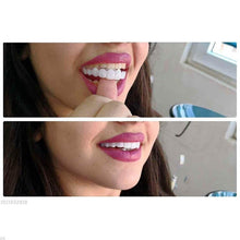 Load image into Gallery viewer, Latest Adjustable Snap-On Dentures