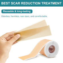 Load image into Gallery viewer, Medical Soft Silicone Gel Tape for Scar Removal