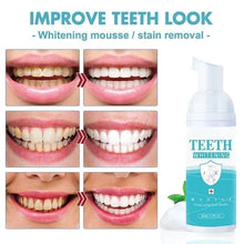 Load image into Gallery viewer, TEETH WHITENING MOUSSE