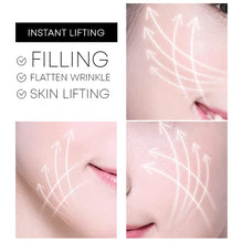 गैलरी व्यूवर में इमेज लोड करें, Protein Thread Lifting Set