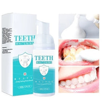 गैलरी व्यूवर में इमेज लोड करें, TEETH WHITENING MOUSSE
