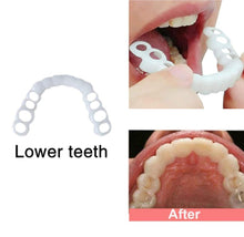 Load image into Gallery viewer, Latest Adjustable Snap-On Dentures
